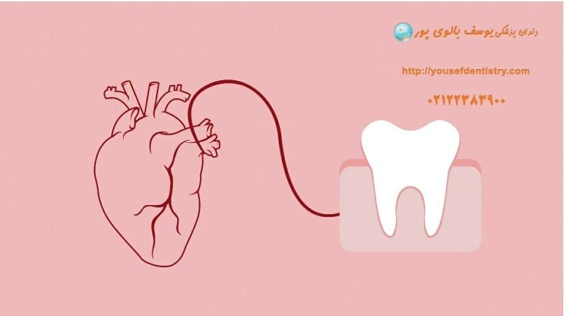 بهداشت دهان و دندان چقدر در سلامت دندان ها تاثیر دارد؟